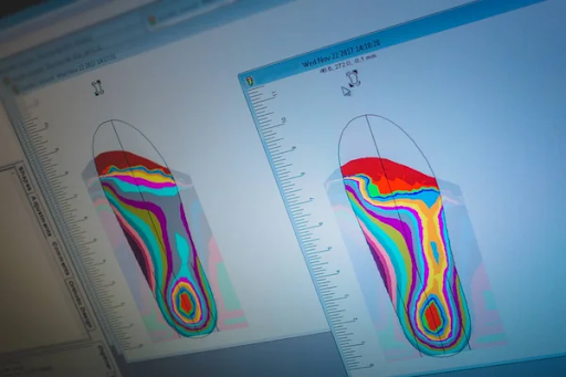 How do shoe insoles with arch support work?