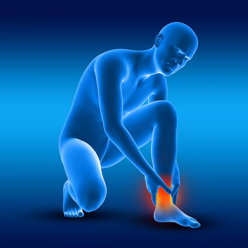 Recognizing The Signs Of Achilles Tendinitis