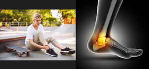 Heel spur vs. Plantar Fasciitis. Understanding the difference