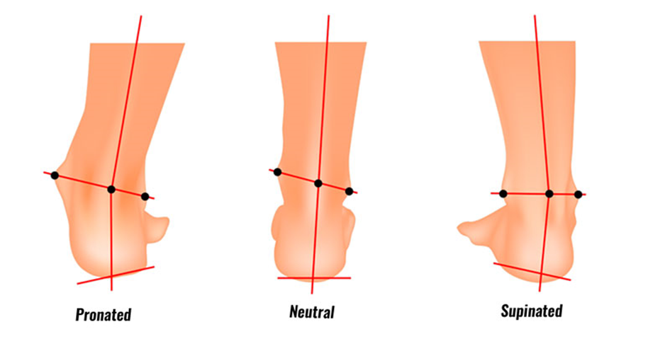 The difference between supination & pronation – OrthoFlexx