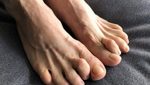 Hammer Toe And Its Associated Foot Pain