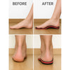 Before and After comparison with Orthoflexx Arch Support Insoles
