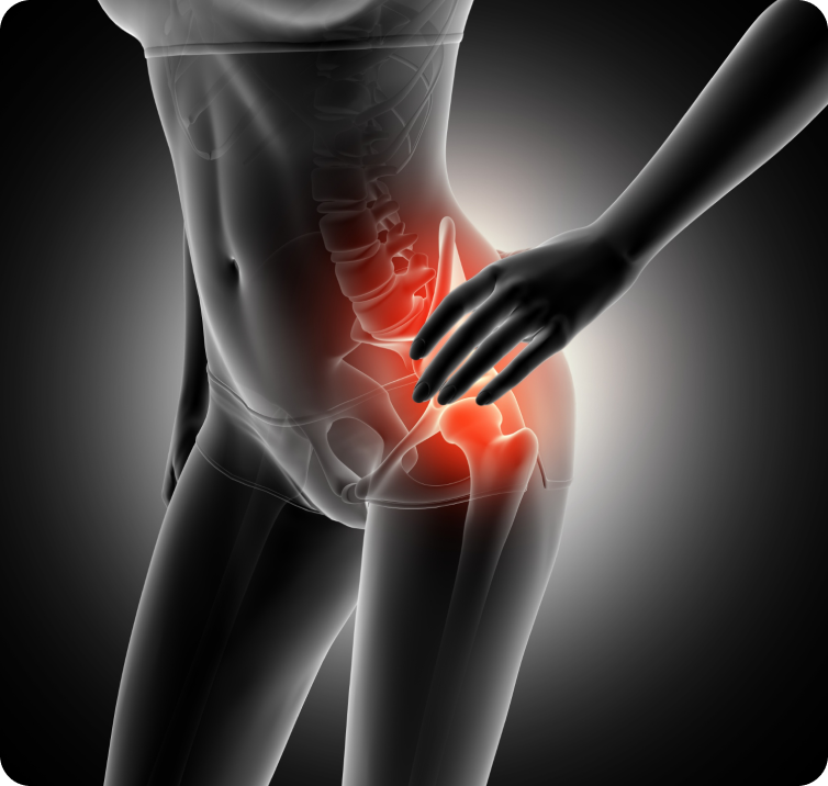Hip misalignment