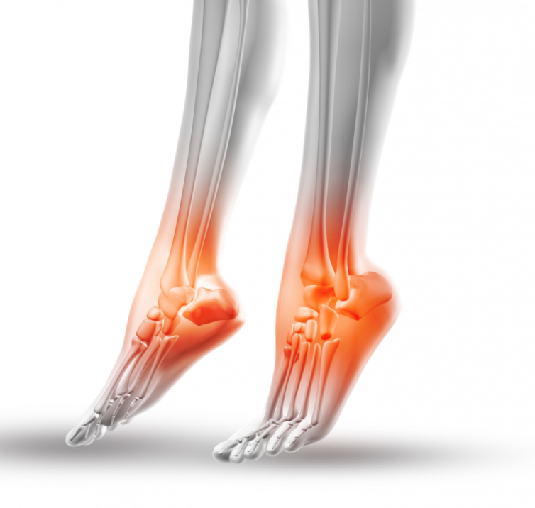 Ankle instability