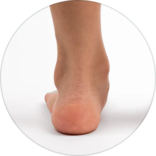 Overpronation & Supination