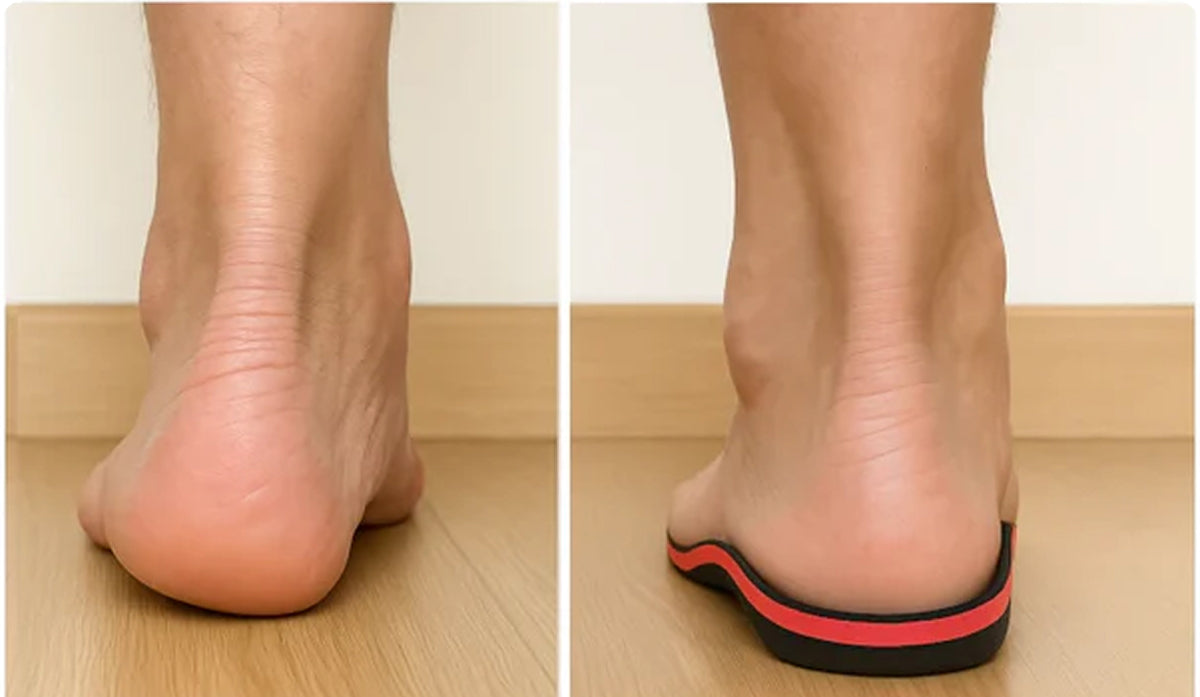 RestoFlex Steps insoles for everyday foot support